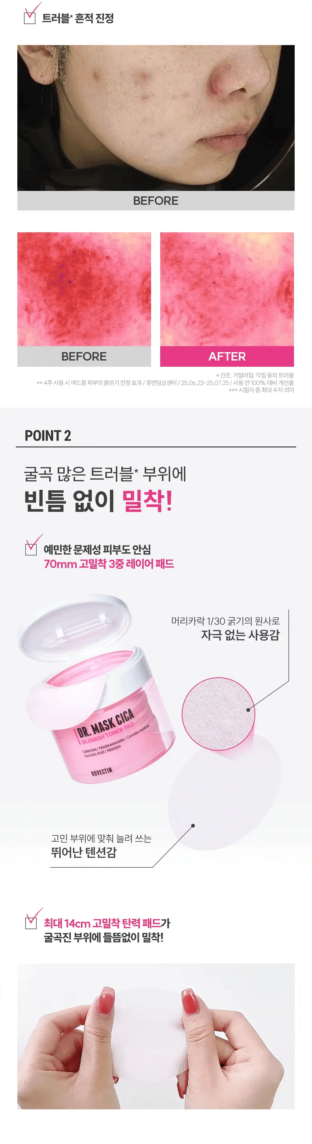 [응급진정/트러블케어] 로벡틴 닥터 마스크 시카 블레미쉬 토너 패드 60매 기획 (+10매) 상세페이지 22